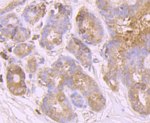 Huntingtin Antibody in Immunohistochemistry (Paraffin) (IHC (P))