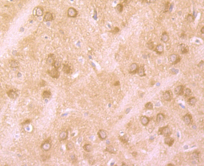 Huntingtin Antibody in Immunohistochemistry (Paraffin) (IHC (P))