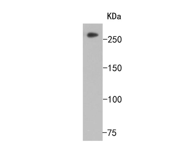 Huntingtin Antibody in Western Blot (WB)