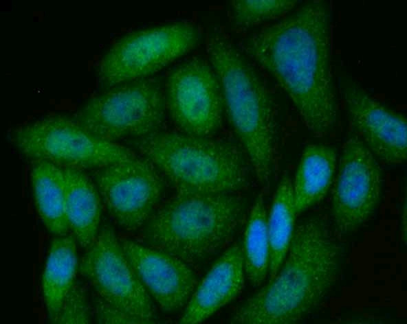 PAK2 Antibody in Immunocytochemistry (ICC/IF)