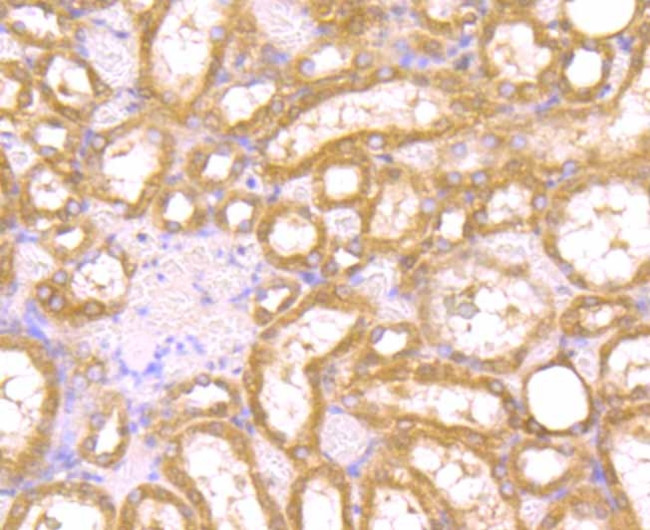 PAK2 Antibody in Immunohistochemistry (Paraffin) (IHC (P))