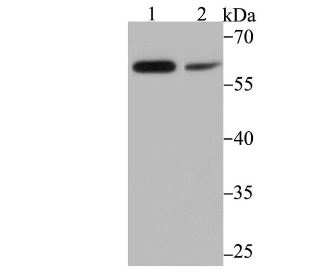 PAK2 Antibody in Western Blot (WB)