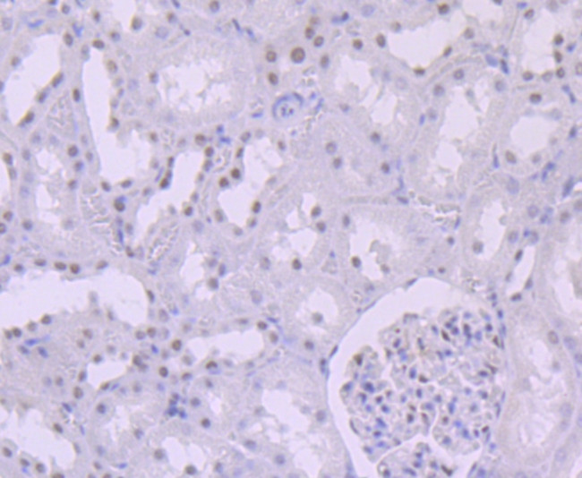 SMARCB1 Antibody in Immunohistochemistry (Paraffin) (IHC (P))