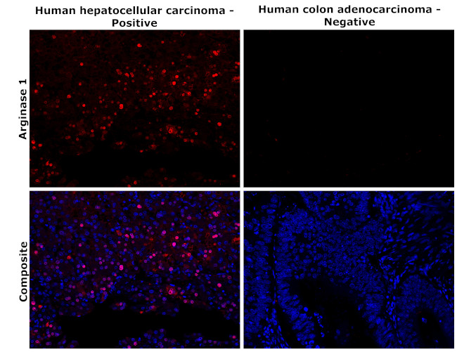 Arginase 1 Antibody in Immunohistochemistry (Paraffin) (IHC (P))