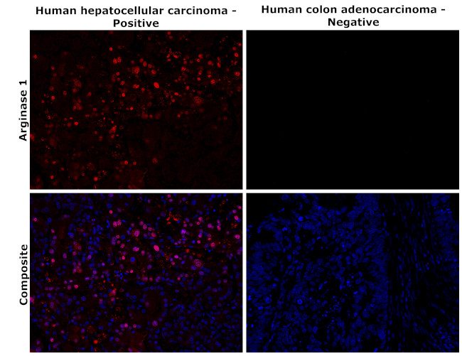 Arginase 1 Antibody in Immunohistochemistry (Paraffin) (IHC (P))