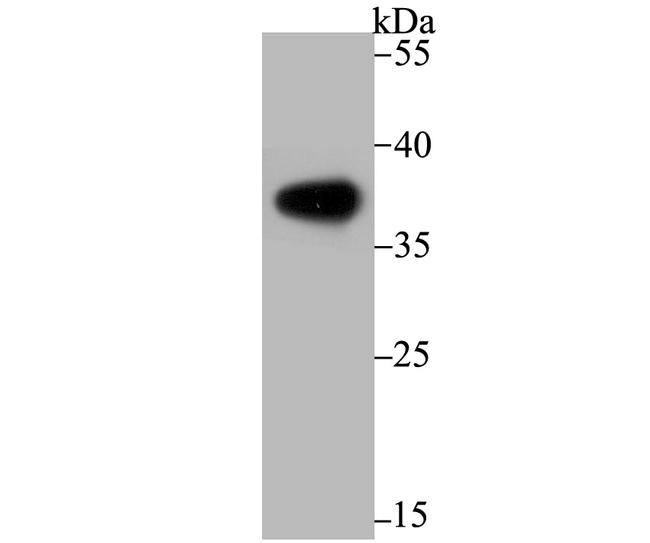 Arginase 1 Antibody in Western Blot (WB)