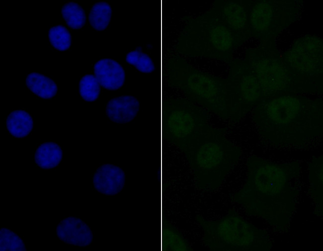 eIF4A3 Antibody in Immunocytochemistry (ICC/IF)