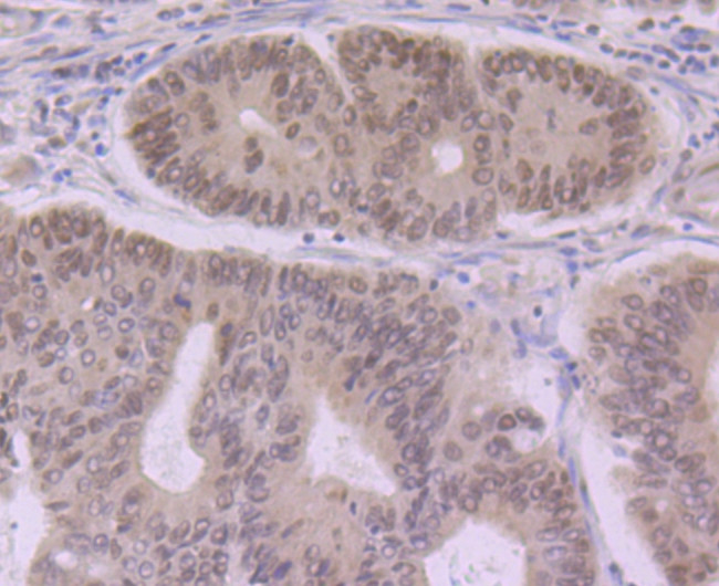 eIF4A3 Antibody in Immunohistochemistry (Paraffin) (IHC (P))