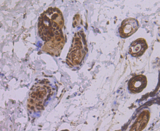 eIF4A3 Antibody in Immunohistochemistry (Paraffin) (IHC (P))