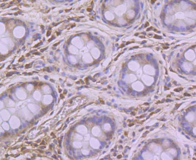 PUM1 Antibody in Immunohistochemistry (Paraffin) (IHC (P))