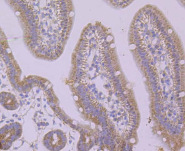 PUM1 Antibody in Immunohistochemistry (Paraffin) (IHC (P))