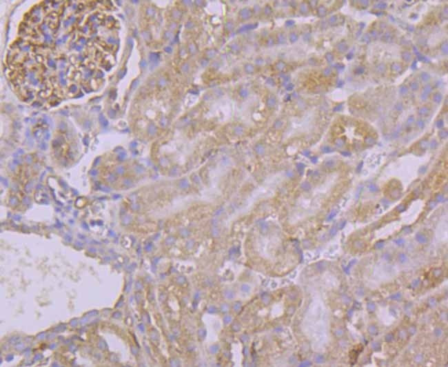 PUM1 Antibody in Immunohistochemistry (Paraffin) (IHC (P))