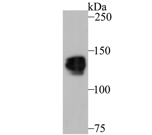 PUM1 Antibody in Western Blot (WB)