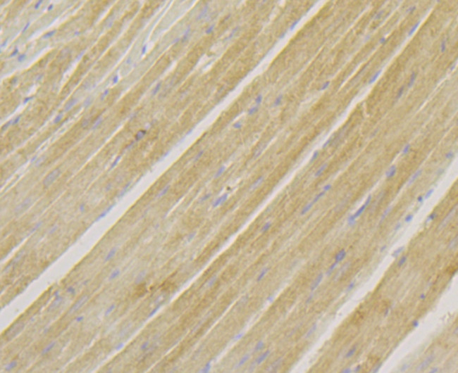 alpha Actinin 2 Antibody in Immunohistochemistry (Paraffin) (IHC (P))