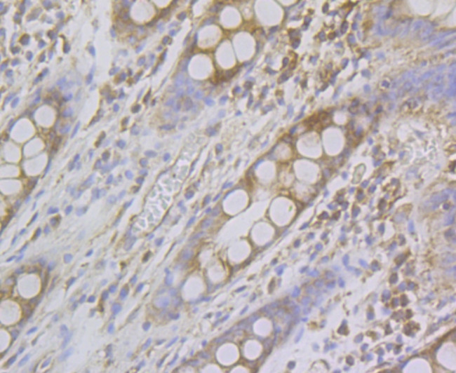 alpha Actinin 2 Antibody in Immunohistochemistry (Paraffin) (IHC (P))