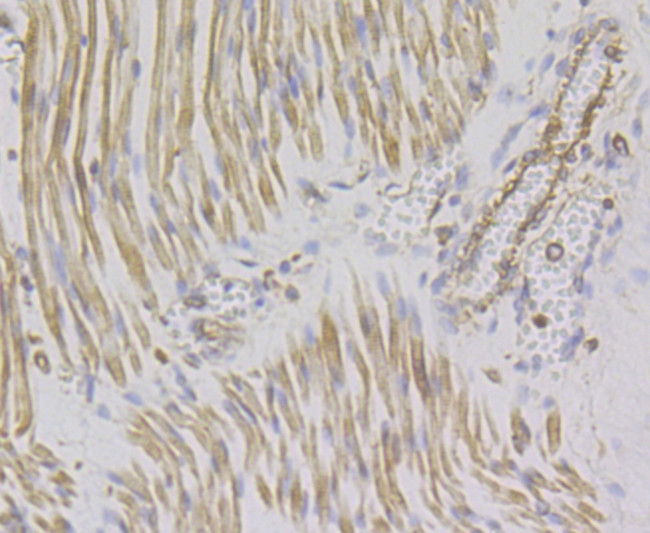 alpha Actinin 2 Antibody in Immunohistochemistry (Paraffin) (IHC (P))