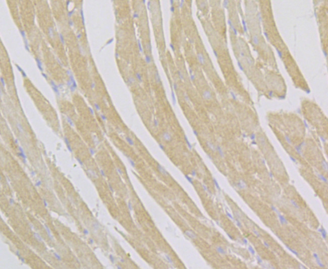 alpha Actinin 2 Antibody in Immunohistochemistry (Paraffin) (IHC (P))