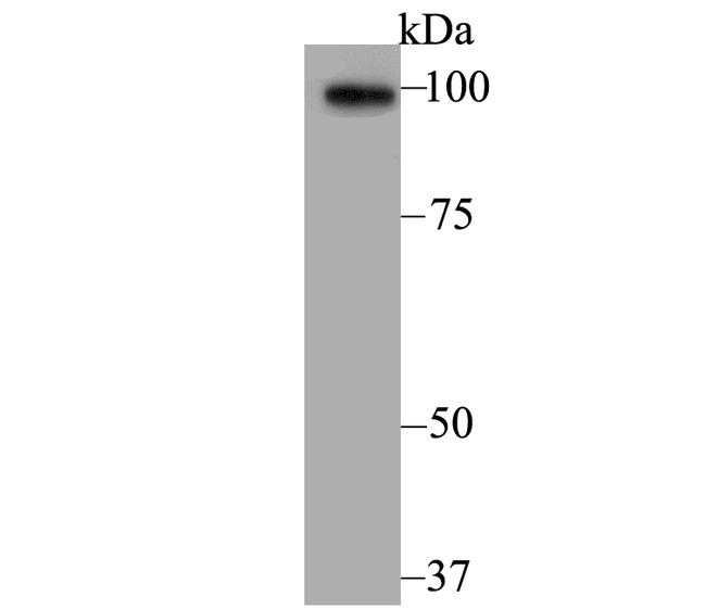 alpha Actinin 2 Antibody in Western Blot (WB)