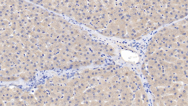 ACVR2A Antibody in Immunohistochemistry (Paraffin) (IHC (P))