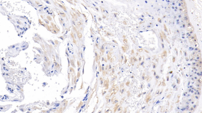 ACVR2A Antibody in Immunohistochemistry (Paraffin) (IHC (P))