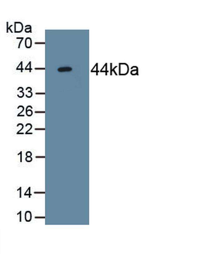 ACVR2A Antibody in Western Blot (WB)