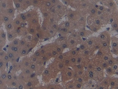 GPT Antibody in Immunohistochemistry (Paraffin) (IHC (P))