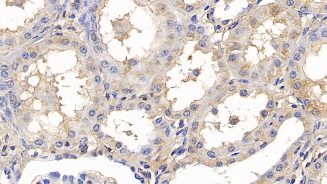 GPT Antibody in Immunohistochemistry (Paraffin) (IHC (P))