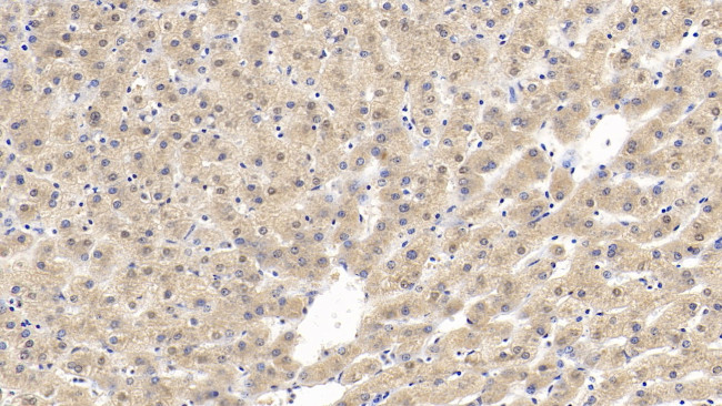 GPT Antibody in Immunohistochemistry (Paraffin) (IHC (P))