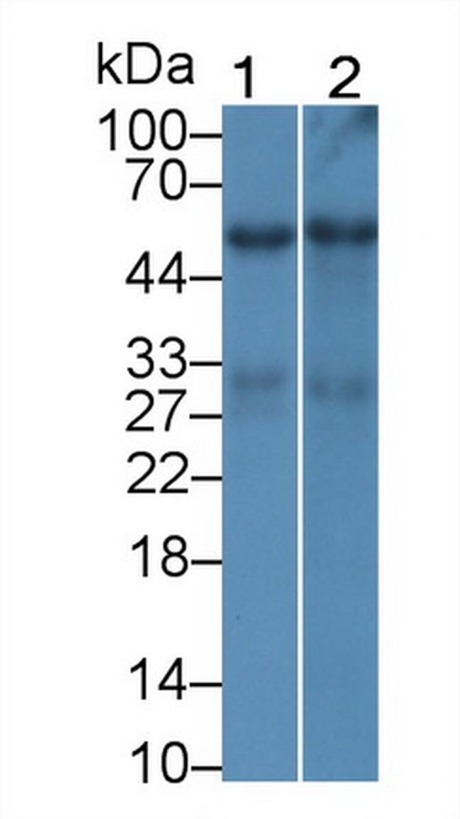 GPT Antibody in Western Blot (WB)