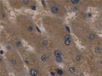 ORM1 Antibody in Immunohistochemistry (Paraffin) (IHC (P))