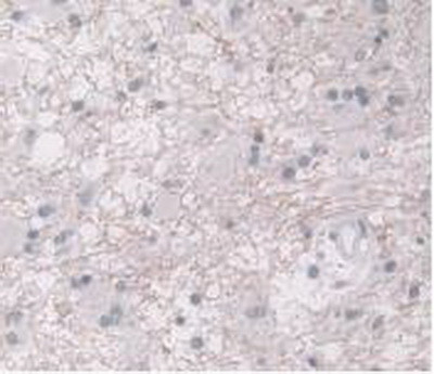 ORM1 Antibody in Immunohistochemistry (Paraffin) (IHC (P))