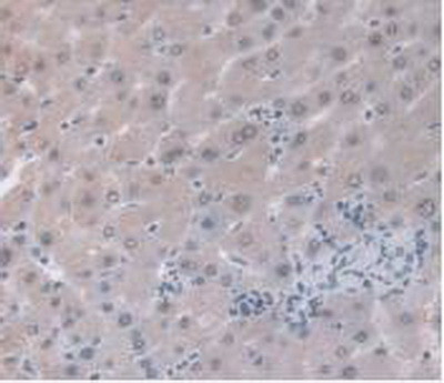 ORM1 Antibody in Immunohistochemistry (Paraffin) (IHC (P))