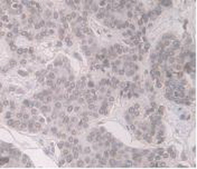 ORM1 Antibody in Immunohistochemistry (Paraffin) (IHC (P))