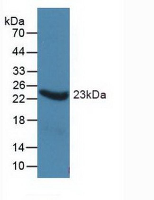 ORM1 Antibody in Western Blot (WB)