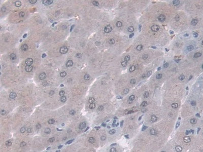 ORM1 Antibody in Immunohistochemistry (Paraffin) (IHC (P))