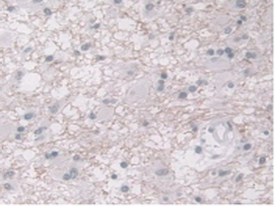 ORM1 Antibody in Immunohistochemistry (Paraffin) (IHC (P))