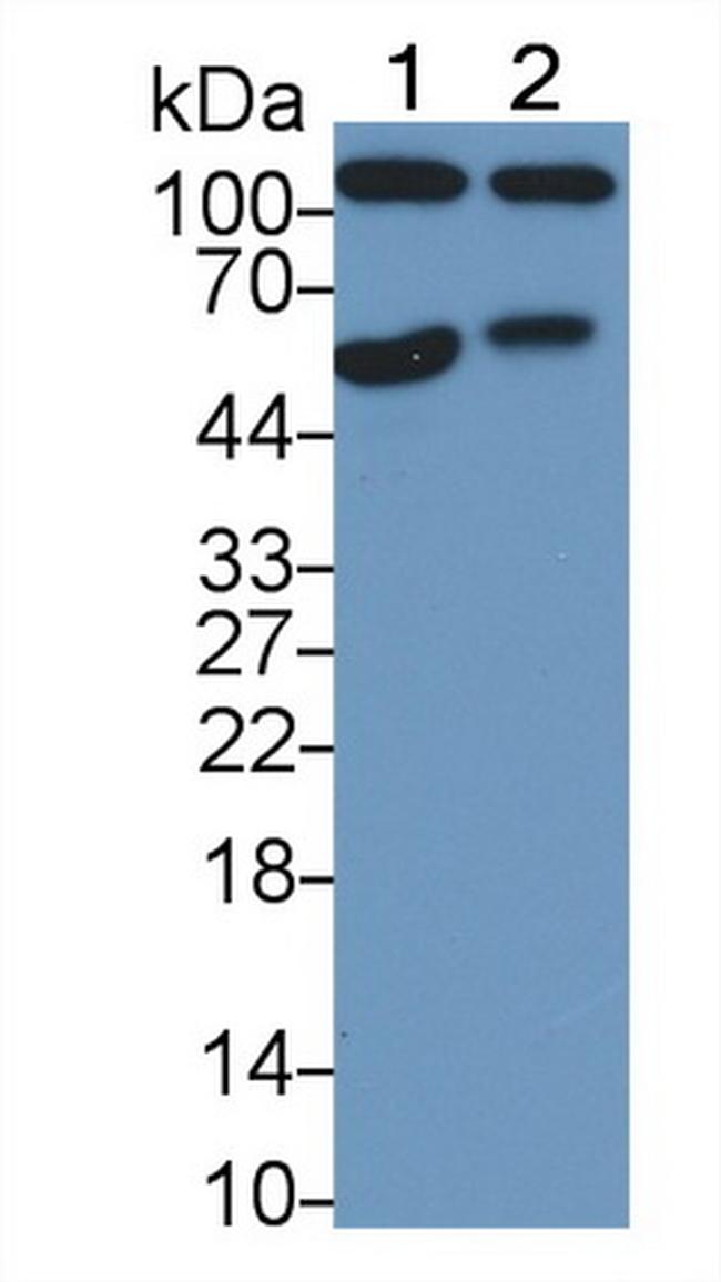 Amphiregulin Antibody in Western Blot (WB)