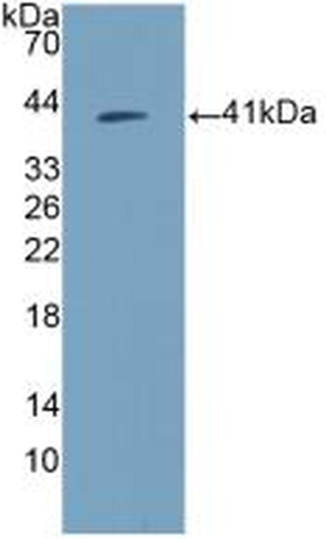 Amphiregulin Antibody in Western Blot (WB)