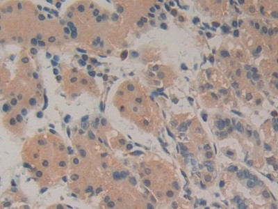 Amphiregulin Antibody in Immunohistochemistry (Paraffin) (IHC (P))