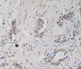 Amphiregulin Antibody in Immunohistochemistry (Paraffin) (IHC (P))