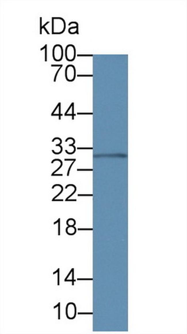 Amphiregulin Antibody in Western Blot (WB)