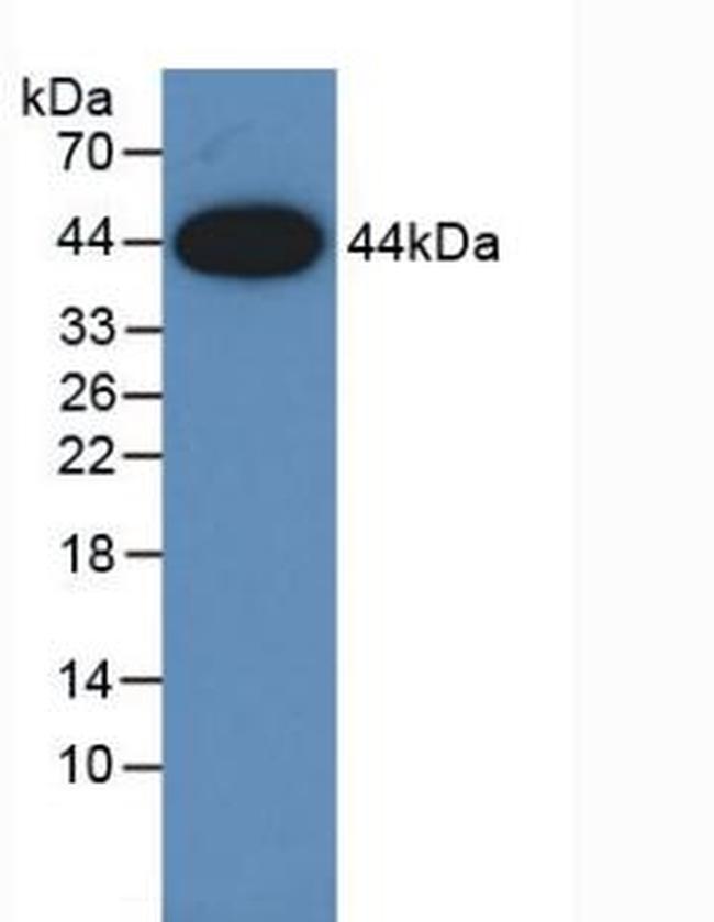 Amphiregulin Antibody in Western Blot (WB)