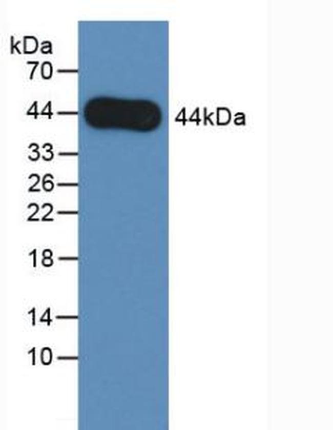 Amphiregulin Antibody in Western Blot (WB)