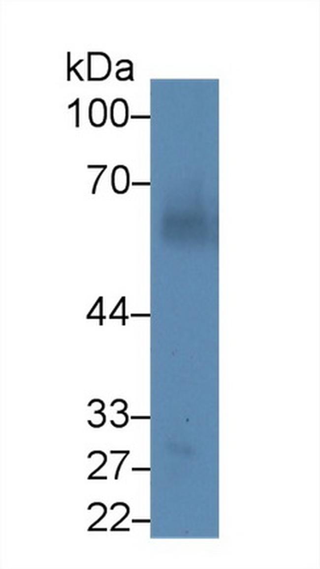 Angiopoietin 1 Antibody in Western Blot (WB)