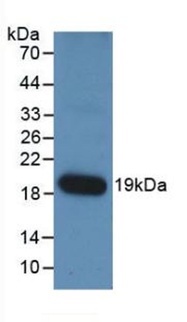 Angiopoietin 1 Antibody in Western Blot (WB)