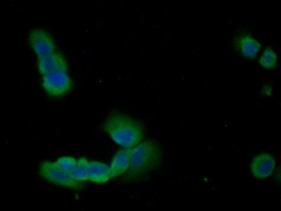 Annexin A1 Antibody in Immunocytochemistry (ICC/IF)