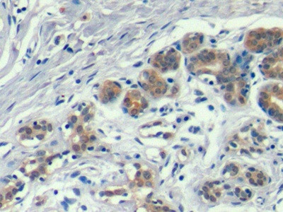 Annexin A1 Antibody in Immunohistochemistry (Paraffin) (IHC (P))