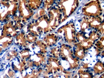 Annexin A1 Antibody in Immunohistochemistry (Paraffin) (IHC (P))