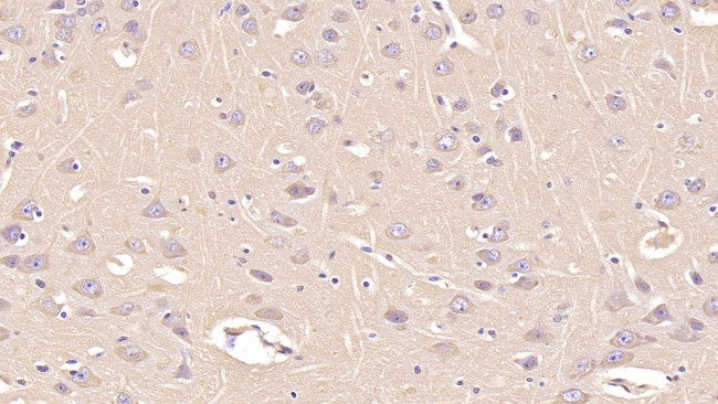 Annexin V Antibody in Immunohistochemistry (Paraffin) (IHC (P))