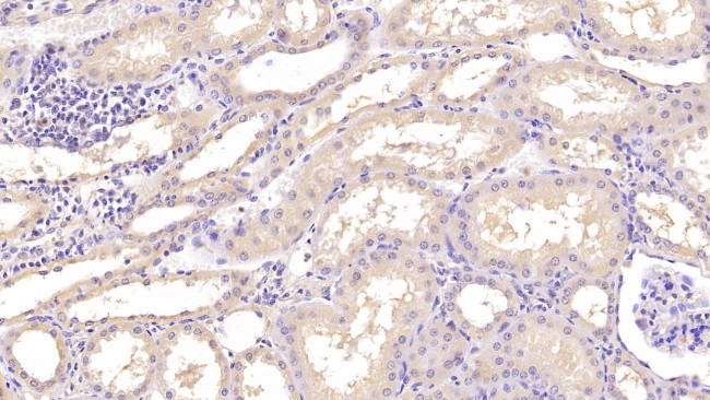 Annexin V Antibody in Immunohistochemistry (Paraffin) (IHC (P))